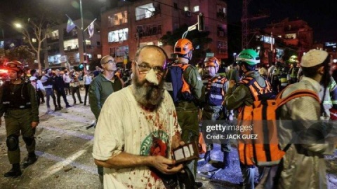 زخمی شدن ۶۳ صهیونیست در حملات موشکی ایران