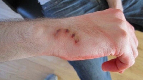 ۸۰ درصد بیماری‌ها از حیوان به انسان منتقل می‌شود/ ۲۴ میلیون یورو هزینه سالانه واکسن هاری