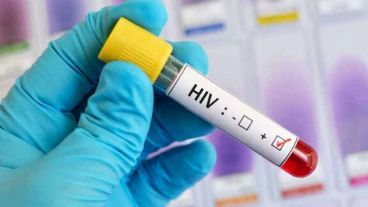 درخواست سازمان جهانی بهداشت برای اولویت قرار دادن پیشگیری از «اچ‌آی‌وی»