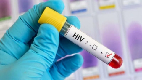 درخواست سازمان جهانی بهداشت برای اولویت قرار دادن پیشگیری از «اچآیوی»