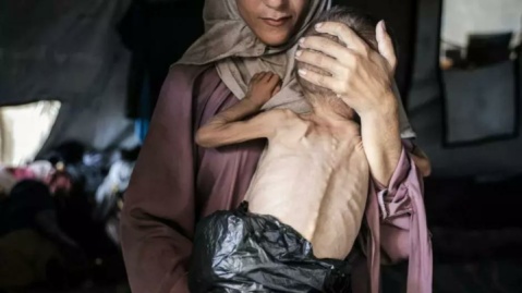 ظفرقندی: استفاده از گرسنگی علیه مردم غزه، فاجعه‌ انسانی و ننگی تاریخی است