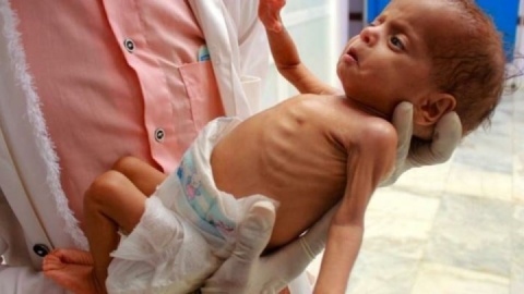 دست و پنجه نرم کردن ۱۷ هزار کودک فلسطینی با گرسنگی/ یک شیرخوار دیگر شهید شد