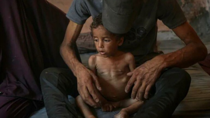 شهادت 5 نفر به دلیل گرسنگی طی 24 ساعت گذشته