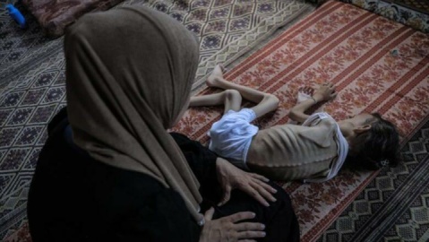 اتهام اجرای کارزار عمدی گرسنگی توسط اسرائیل در نوار غزه