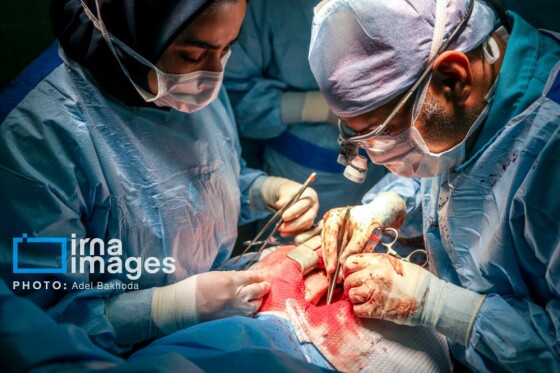 همدان؛ قطب عمل قلب در غرب کشور