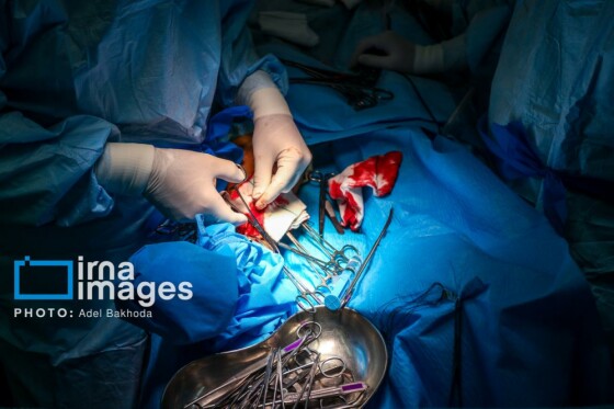 همدان؛ قطب عمل قلب در غرب کشور