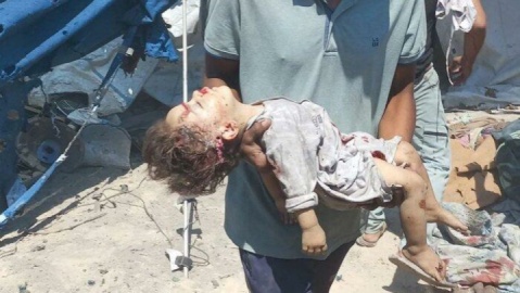 غزه در محاصره مرگ و سکوت جهانی ، ۶۳ هزار شهید، ۲ هزار قربانی نان