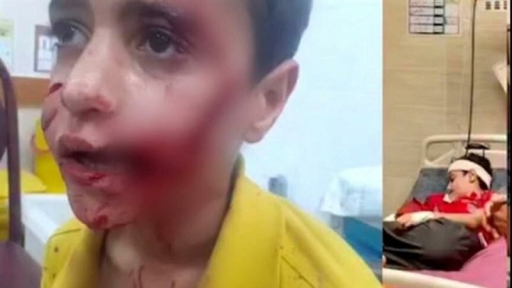 مرگ کودک ۱۱ ساله به‌خاطر حمله ‌سگ‌های ولگرد!