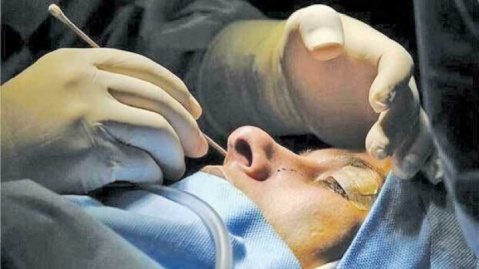 پزشک عمومی نباید دست به تیغ شود