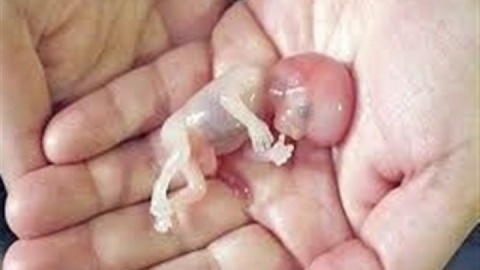 ۶ شرط سقط جنین اعلام شد