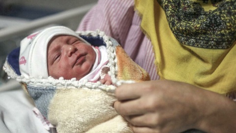 ۶۰ درصد نوزادان رسیده و ۸۰ درصد نوزادان نارس زردی را تجربه می‌کنند