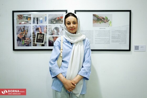 نمایشگاه عکس و قصه رهیدگان سوختگی