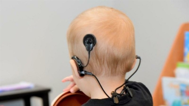 سالانه بیش از ۲ هزار کاشت پروتز شنوایی در کشور انجام می‌شود