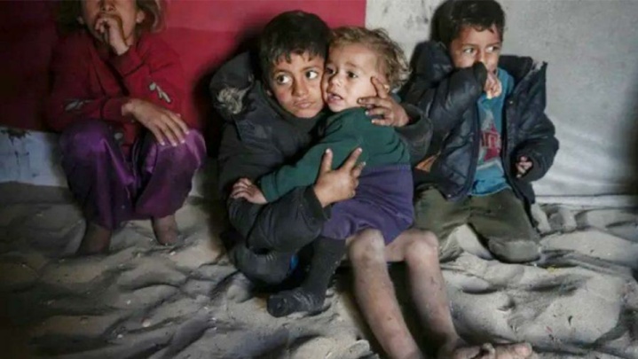 فاجعه ژنتیکی در غزه؛ زخم‌های نسل‌کشی بر تن کودکان آینده