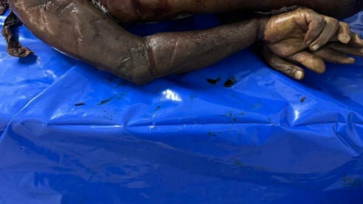 گزارش وزارت بهداشت غزه از وضعیت هولناک پیکرهای اسرای شکنجه‌شده