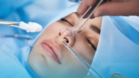 عمل بینی همچنان در صدر عمل‎های زیبایی