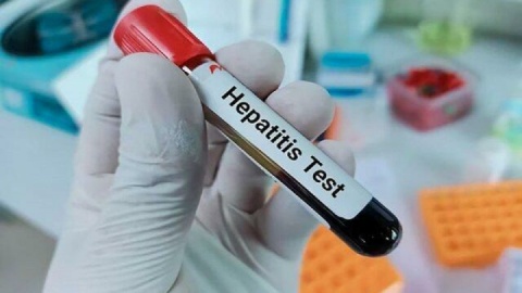 هشدار شیوع بالای هپاتیت A در کودکان و نوجوانان ایرانی