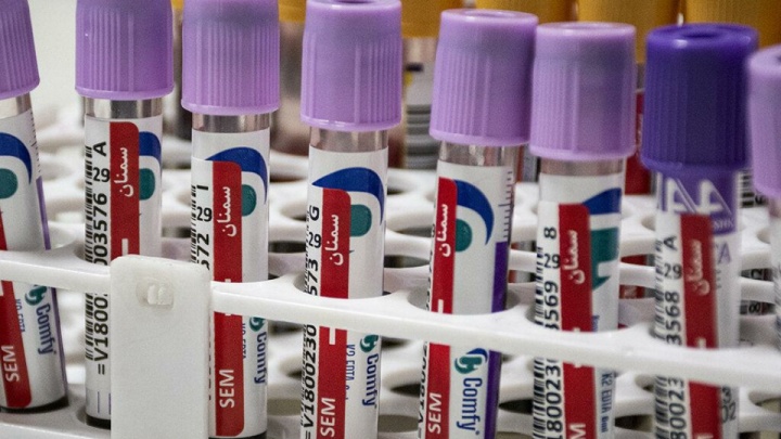 تفسیر غیرتخصصی نتایج آزمایش‌های پزشکی توسط سامانه‌های هوش مصنوعی