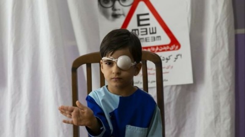 درمان بیش از ۱۳ هزار مورد تنبلی چشم در کودکان