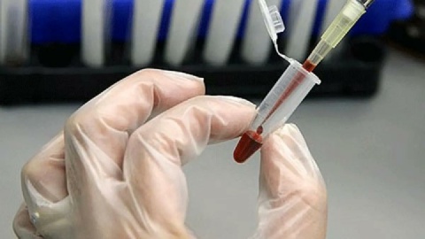 ۷۵۰ هزار تومان هزینه سالانه نگهداری خون بند ناف