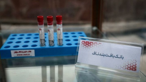 ایران رتبه دوم جهان در ذخیره‌سازی خون بند ناف