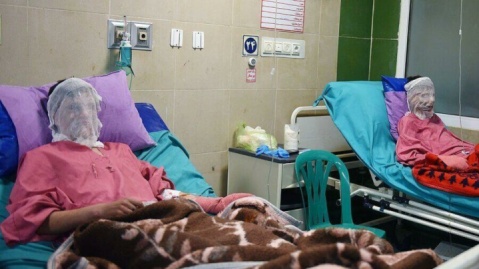 میزان سوختگی در ایران ۸ برابر میانگین جهانی/کارگران ساختمانی بیشترین قربانیان برق گرفتگی