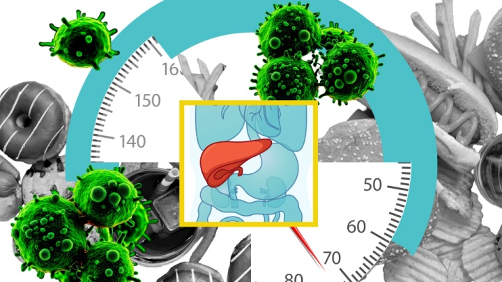 غذاهای چرب، زمینه‌ساز سرطان کبد می‌شوند