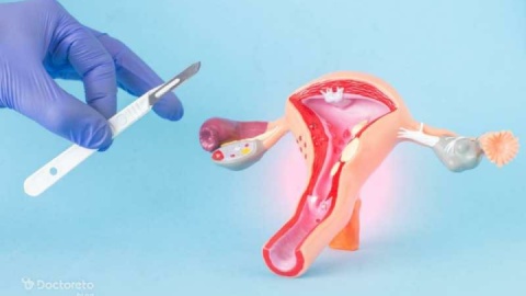 ایران در درمان اندومتریوز بالاتر از اروپا و آمریکا