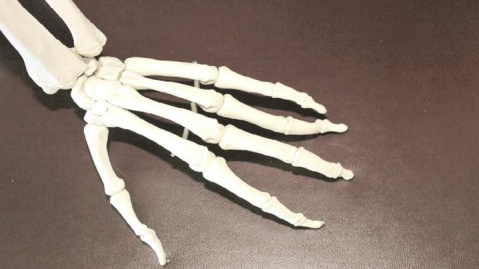 استخوان مصنوعی، امید تازه برای درمان شکستگی