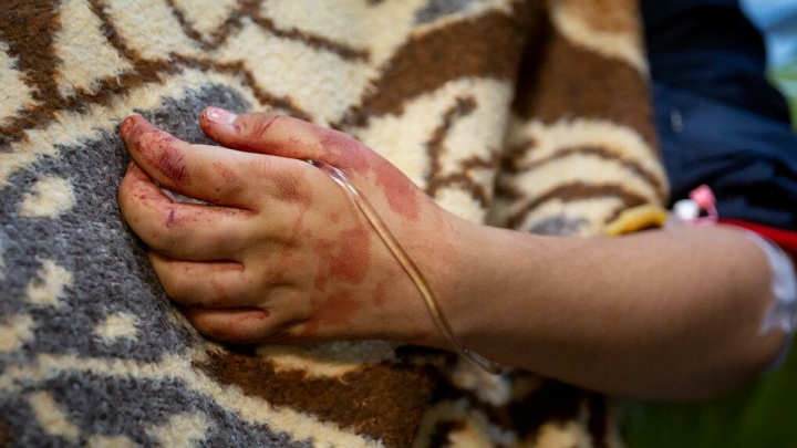 پذیرش و درمان رایگان مصدومان حوادث اخیر در مراکز درمانی کشور