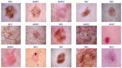 نشانه‌های پوستی که از بیماری خبر می‌دهند