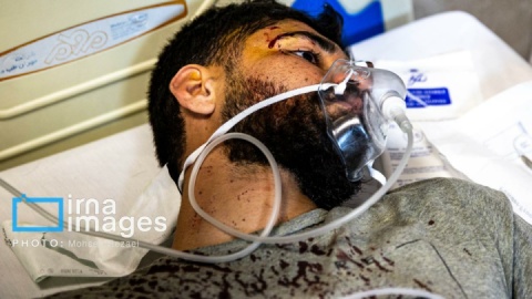 گزارش تصویری/ مجروحین حمله هوایی آمریکا و رژیم صهیونیستی به تهران