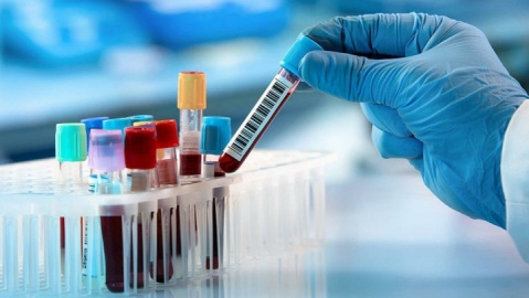 سرنوشت دو پسرخاله در گرو آزمایش « دی ان ای»