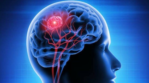 این ۷ عادت خطرناک را همین الان ترک کنید / پیشگیری از سکته مغزی
