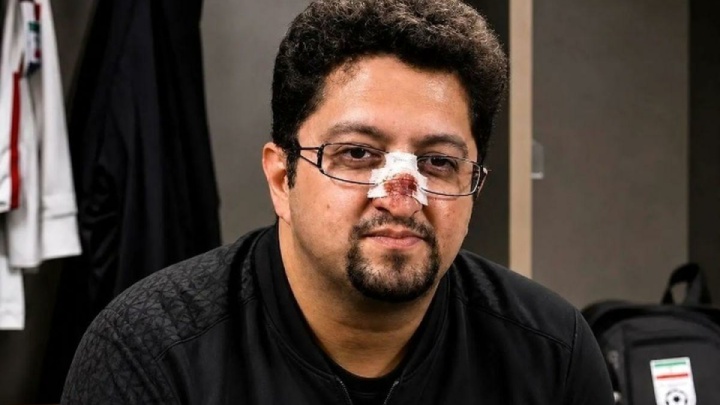 شجاع گل زد،افاضلی مصدوم شد