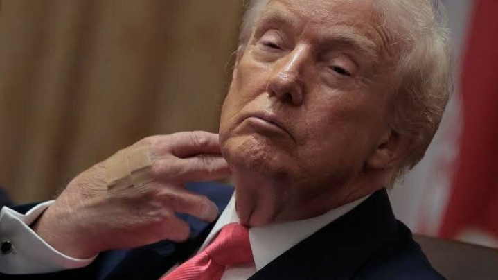 گزارش واشنگتن‌پست از افزایش مشکلات سلامتی ترامپ